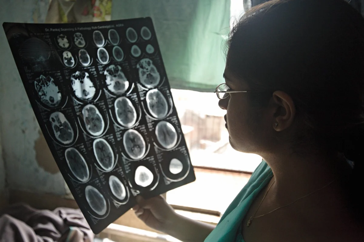 urgent action needed on neurological care