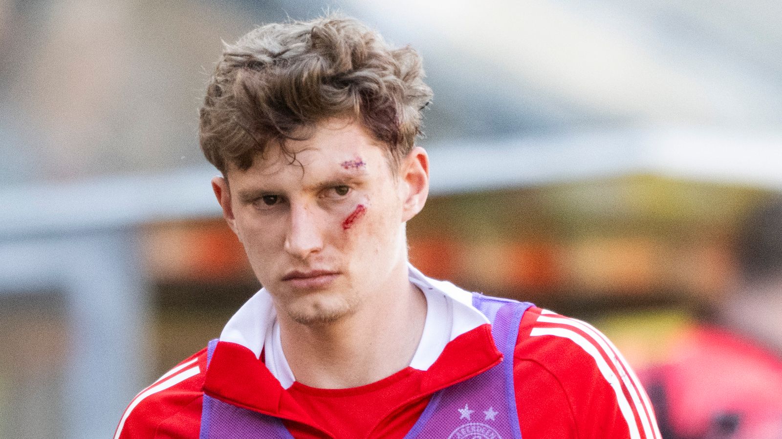 Aberdeen fan jailed for 18-months for injuring Dons player Jack MacKenzie after throwing seat onto pitch | Football News